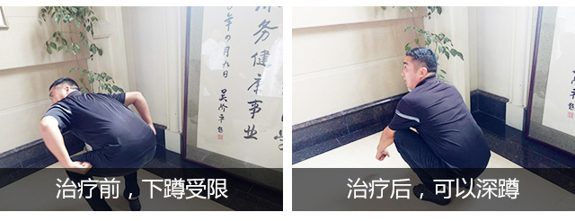四期治疗前后.jpg